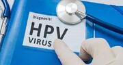 شیوع بالای HPV در تهران صحت دارد؟