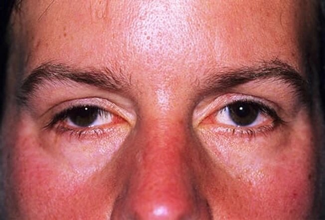 صورت ما در مورد بیماریها چه میگوید؟