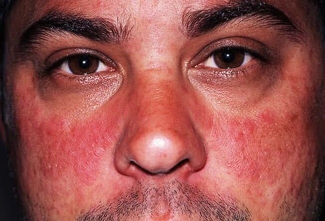 صورت ما در مورد بیماریها چه میگوید؟