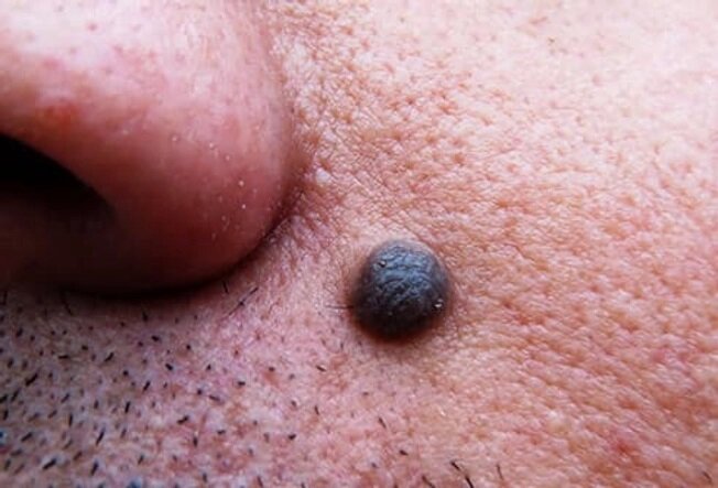 صورت ما در مورد بیماریها چه میگوید؟