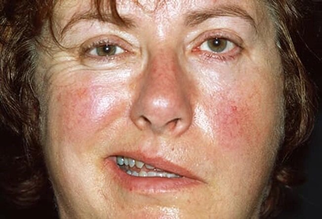 صورت ما در مورد بیماریها چه میگوید؟