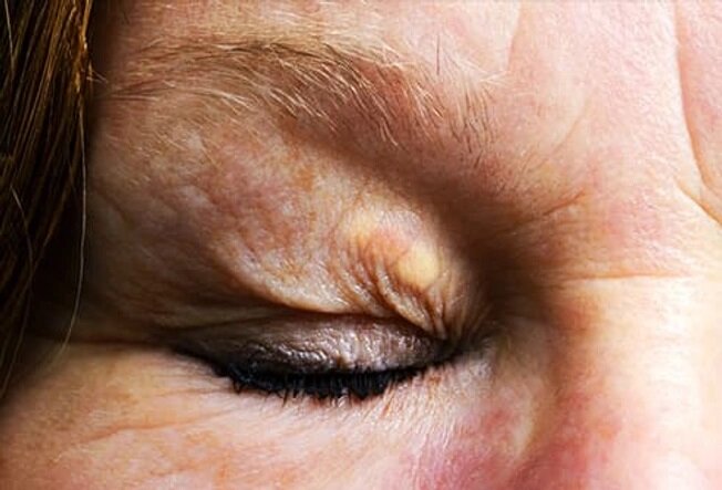 صورت ما در مورد بیماریها چه میگوید؟