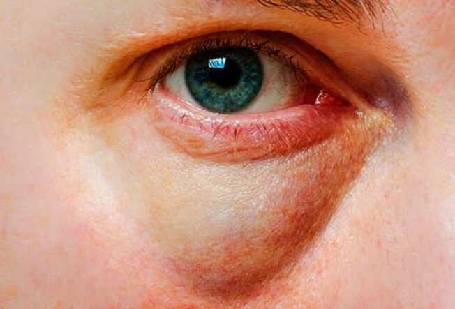 صورت ما در مورد بیماریها چه میگوید؟