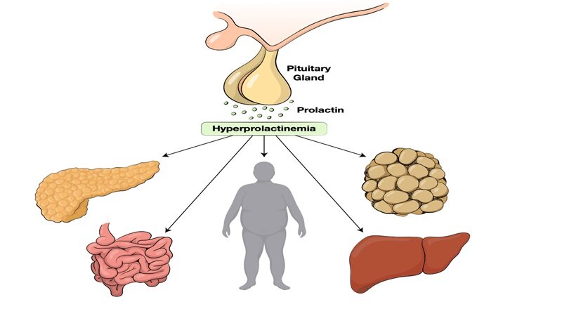 پرولاکتین (هورمون شیر) چیست؟ عوارض و درمان پرولاکتین بالا