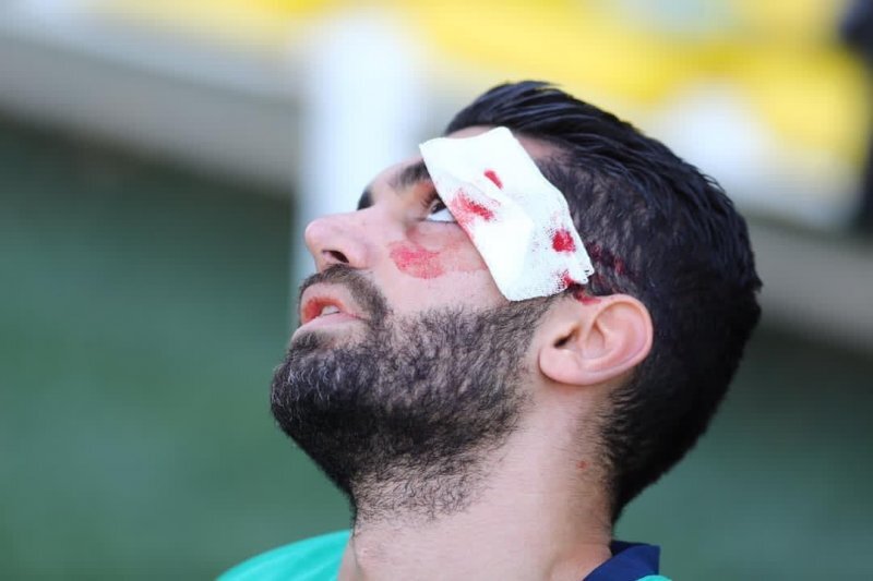 از دندان های جواد اللهوردی تا دندان عالیشاه | آسیب های رایج در فوتبال ایران کدام ها هستند؟