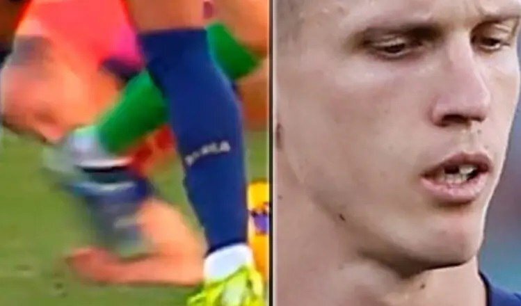 ستاره بارسا برای دندان گمشدهاش جایزه گذاشت!