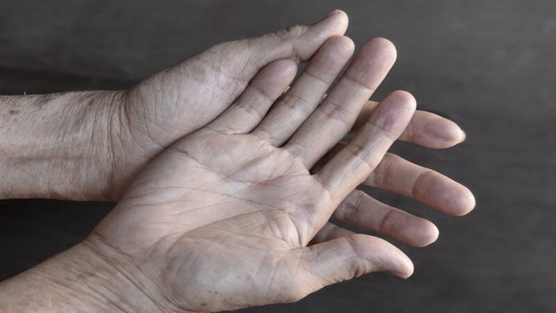 نشانه های عجیب افت قند خون که نمی دانید!