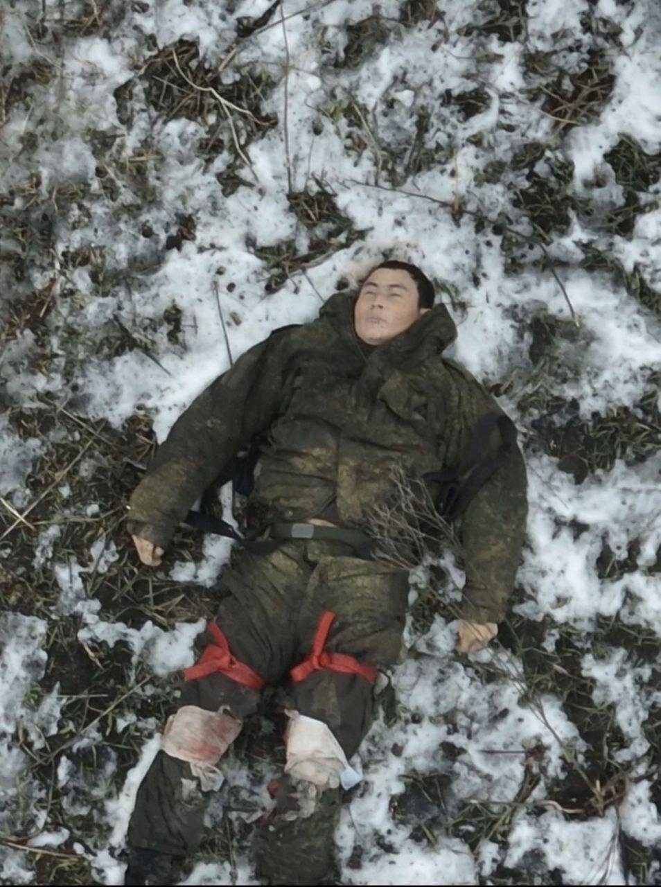 عکس و فیلم واضح سربازان کره شمالی در بیمارستان روسیه