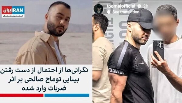 معجزه جدید از زندانیان امنیتی! دوباره علم پزشکی را زیر سؤال بردند! + تصاویر | دختری که گفته میشد به وی تجاوز شده و موهایش را تراشیدهاند ...