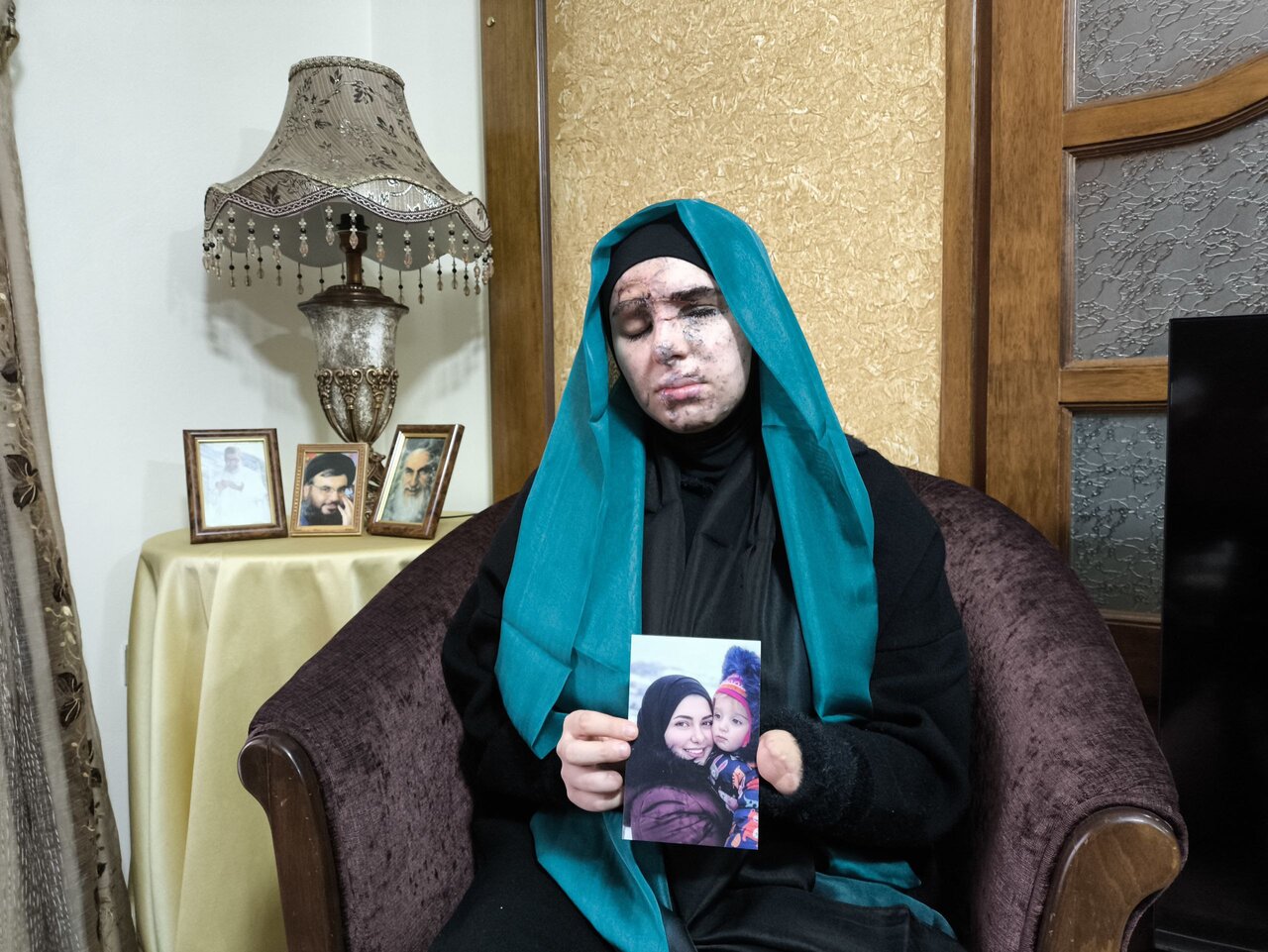 جانباز زن حادثه تروریستی پیجرها؛ تصویر قبل و بعد روان الموسوی را ببینید | تصاویر