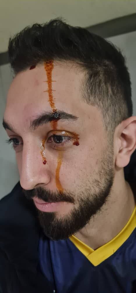 کتک کاری در لیگ برتر والیبال ؛ حمله هواداران به تیم مهمان | صورتهای خونین و کبود بازیکنان و سرمربی شهرداری ارومیه را ببینید