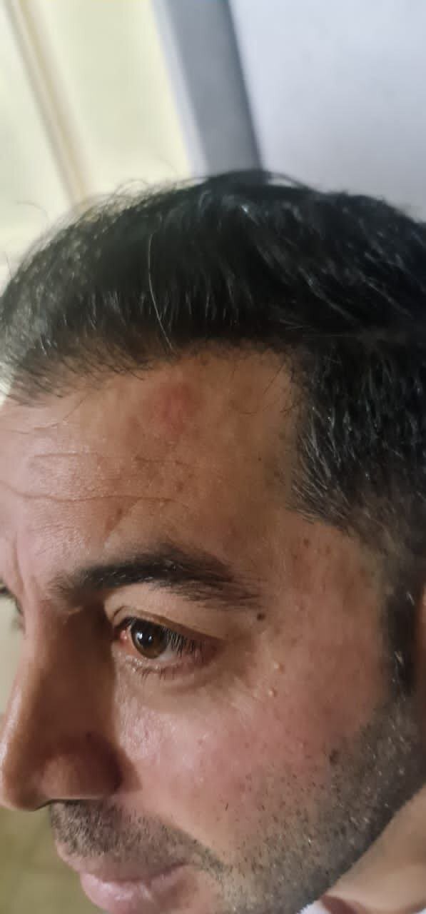 کتک کاری در لیگ برتر والیبال ؛ حمله هواداران به تیم مهمان | صورتهای خونین و کبود بازیکنان و سرمربی شهرداری ارومیه را ببینید