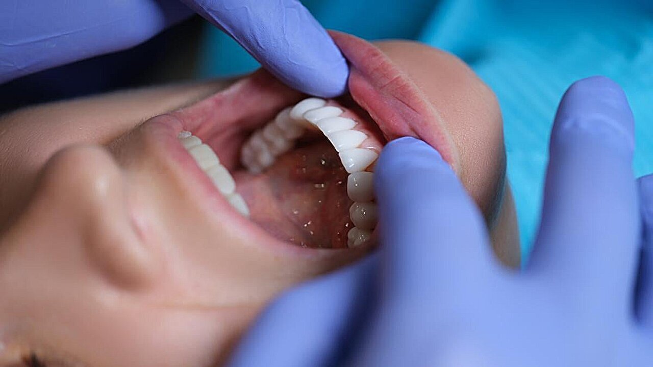 DENTAL