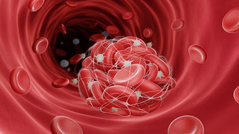 چرا بدون ضربه دچار کبودی میشویم؟ بررسی علل و راهکارهای درمان