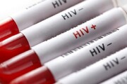 ویروس HIV قابل کنترل است به شرط درمان | درمان «ایدز» رایگان است