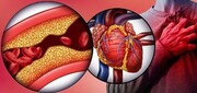 رگ‌هایتان را با این خوراکی‌ها باز کنید + عکس