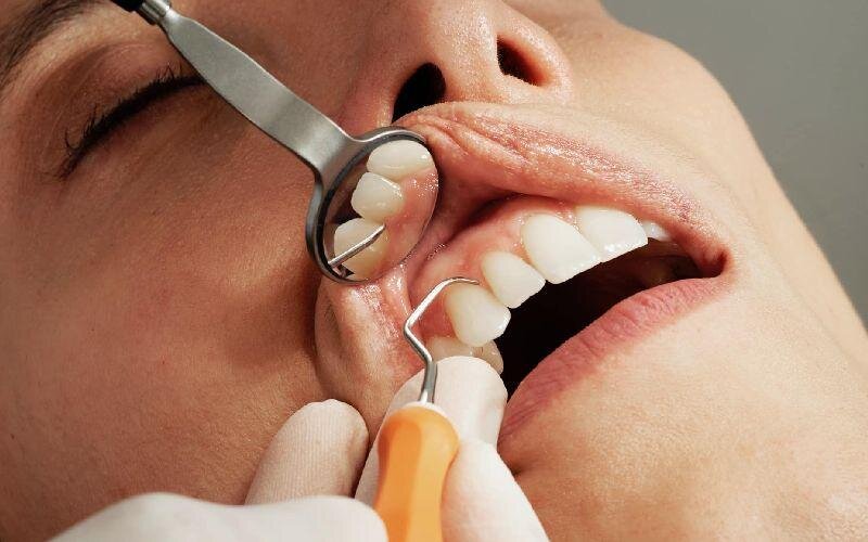 حساسیت دندان چیست؟ وقتی لیوان آب سرد به یک کابوس تبدیل می‌شود!