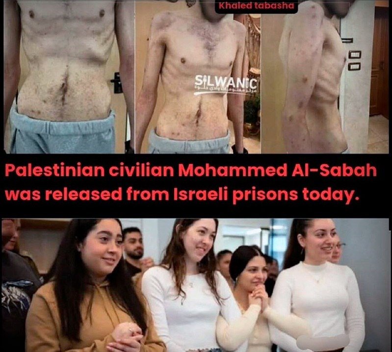 مقایسه وضعیت اسرای فلسطینی و اسرائیلی پس از آزادی | عکس