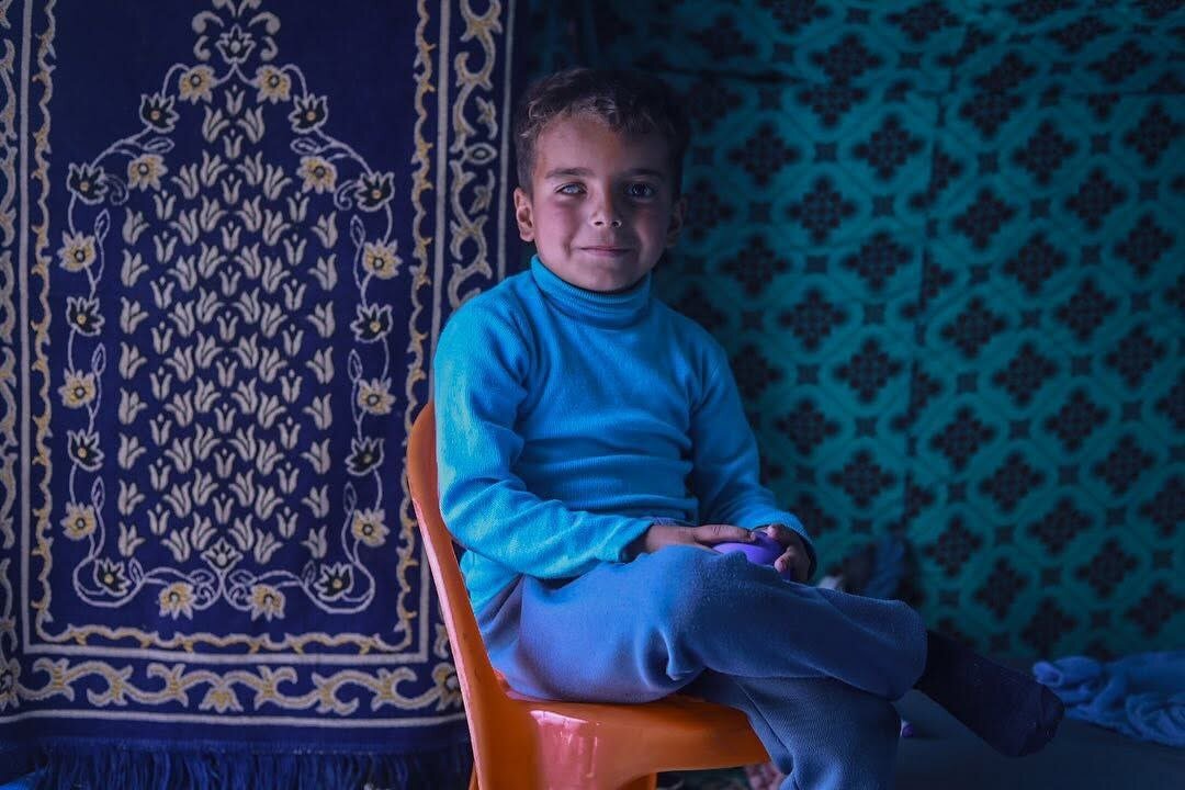 عمران، کودک ۵ ساله غزه‌ای که جنگ هم پدر و هم بینایی چشمانش را از او گرفت | تصاویر