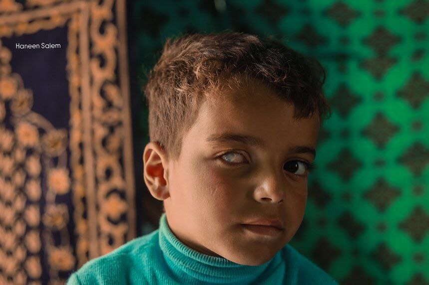 عمران، کودک ۵ ساله غزهای که جنگ هم پدر و هم بینایی چشمانش را از او گرفت | تصاویر