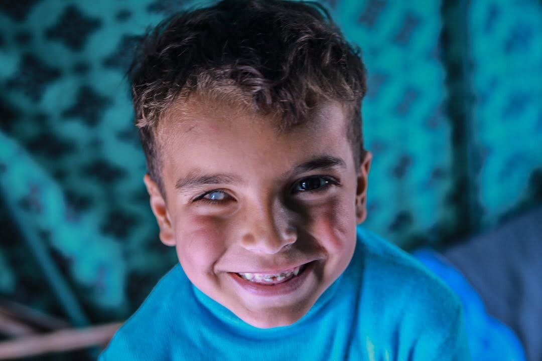 عمران، کودک ۵ ساله غزهای که جنگ هم پدر و هم بینایی چشمانش را از او گرفت | تصاویر