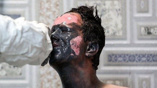 چهارشنبهسوری؛ هر ۳دقیقه یک حادثه+ تصاویر دلخراش | یک کشته و ۷۰ مصدوم تا این لحظه