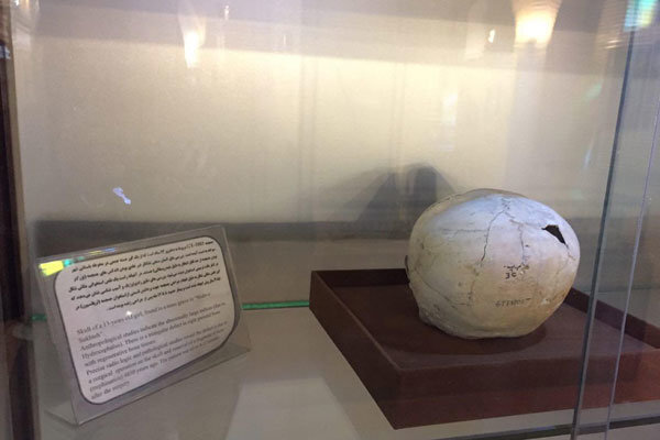 نخستین جراحی موفق مغز به چه زمانی برمیگردد؟ | سوراخ کردن مغز برای خروج ارواح خبیث!