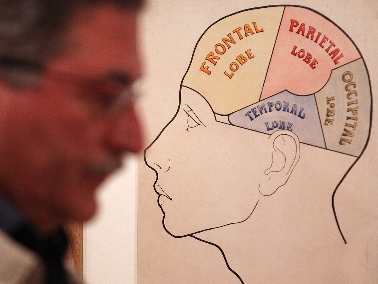 نخستین جراحی موفق مغز به چه زمانی برمیگردد؟ | سوراخ کردن مغز برای خروج ارواح خبیث!