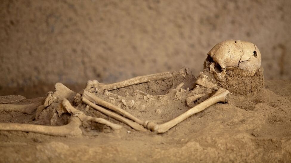 نخستین جراحی موفق مغز به چه زمانی برمیگردد؟ | سوراخ کردن مغز برای خروج ارواح خبیث!