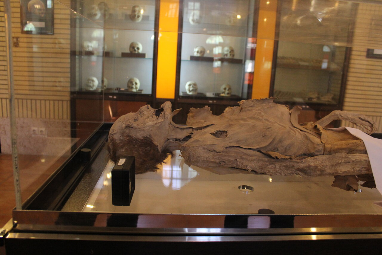 یکی از عجایب تاریخ جهان در این موزه در تهران خفته است | از کالسکه خانه سلطنتی تا موزه تاریخ پزشکی