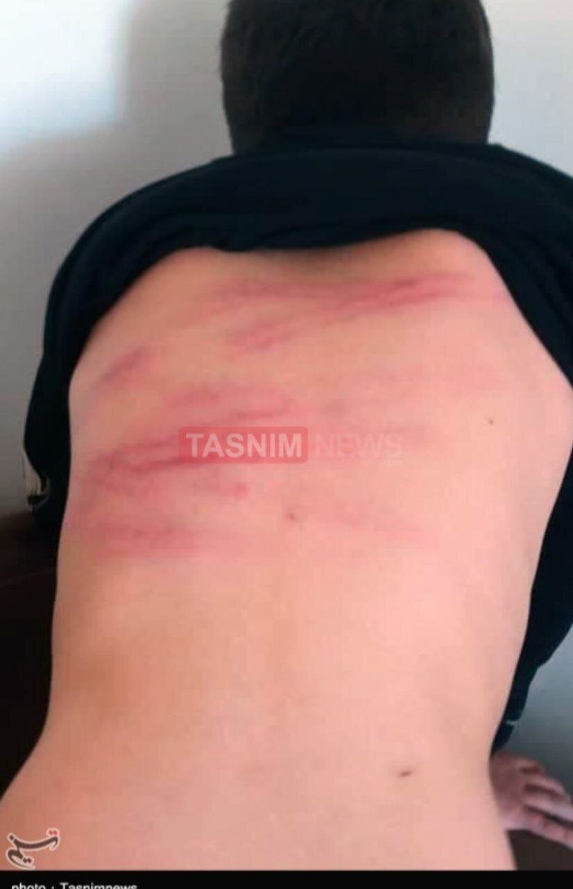 ضرب و شتم شدید دانشآموزان دبستانی توسط معلمشان + تصاویر | بستری شدن یک دانشآموز در بیمارستان | معلم خاطی فارغالتحصیل دانشگاه فرهنگیان است