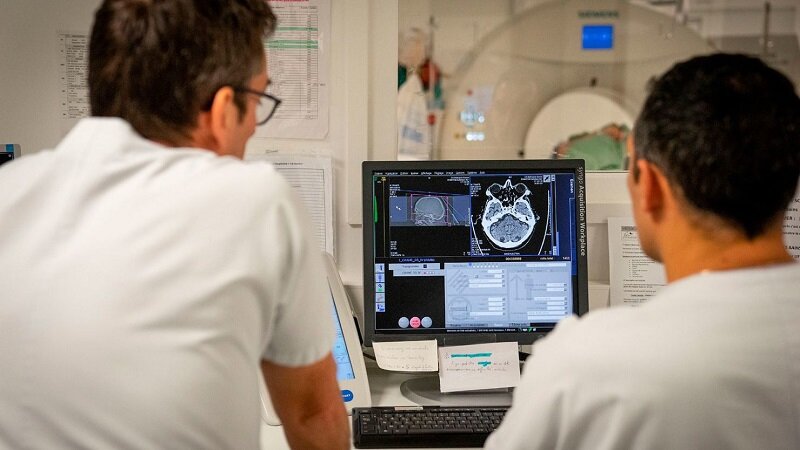 این عوامل خطر سکته مغزی را در افراد زیر ۵۰ سال افزایش میدهند