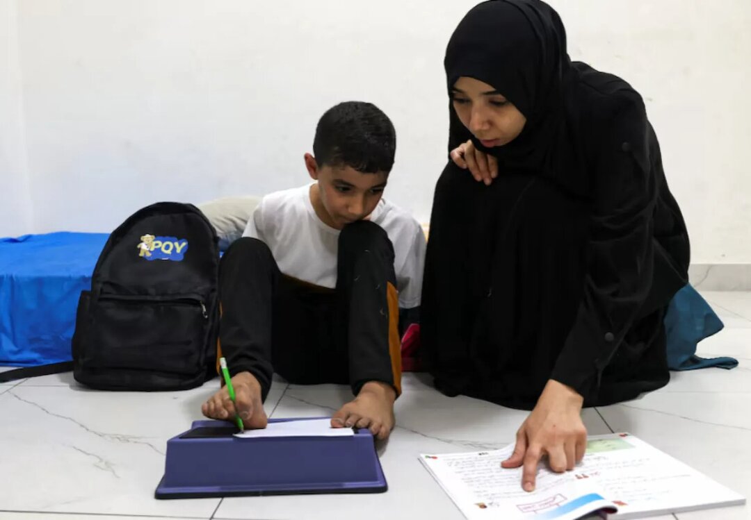 دستهایی که بدون بیهوشی قطع شدند | تصاویر