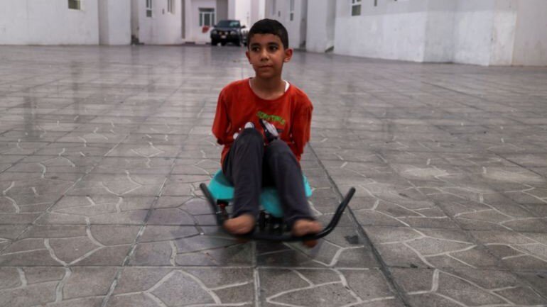 دستهایی که بدون بیهوشی قطع شدند | تصاویر