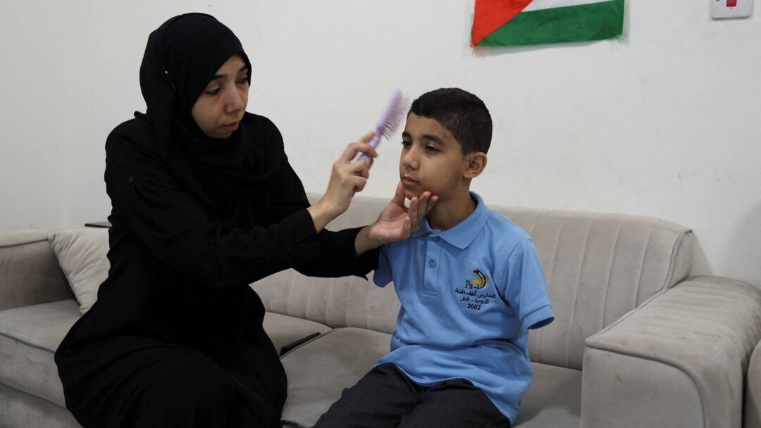 دستهایی که بدون بیهوشی قطع شدند | تصاویر