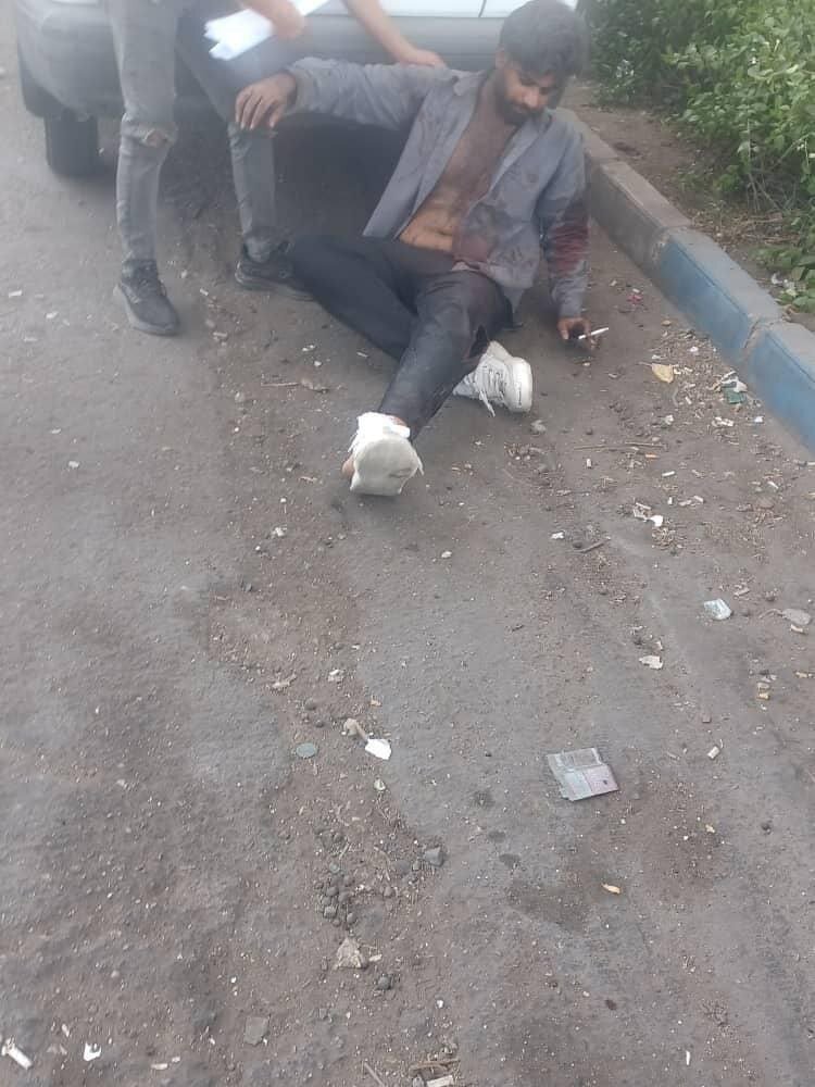 جدیدترین تصاویر از وضعیت مصدومان حادثه انفجار در بندرعباس