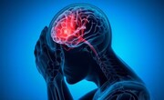 چه کسانی بیشتر در معرض خطر سکته مغزی هستند؟