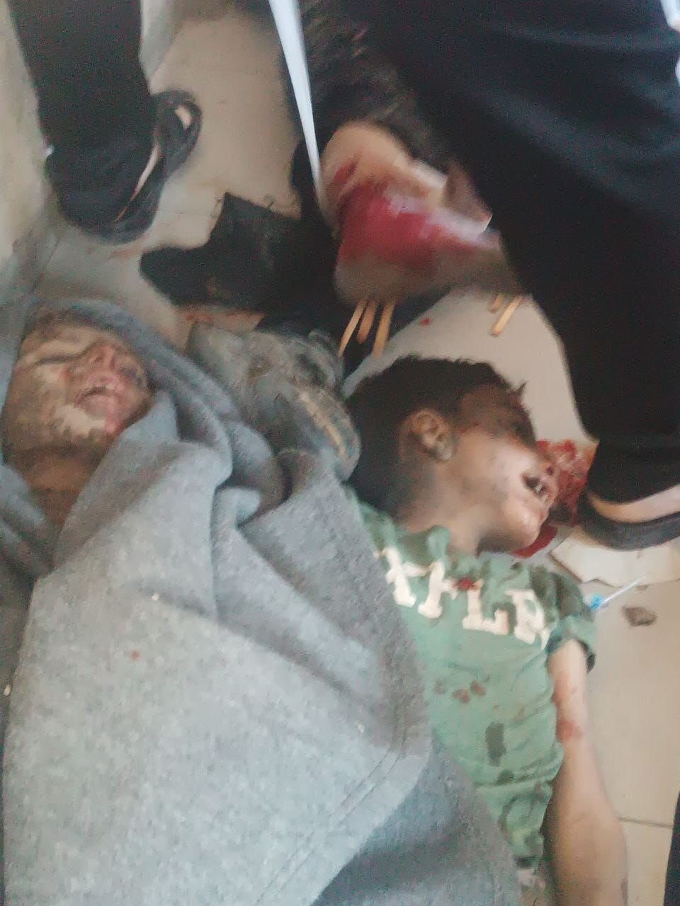 ۱۸+ تصاویری دردناک از پیکرهای کودکان به شهادت رسیده در حمله اخیر اشغالگران صهیونیست