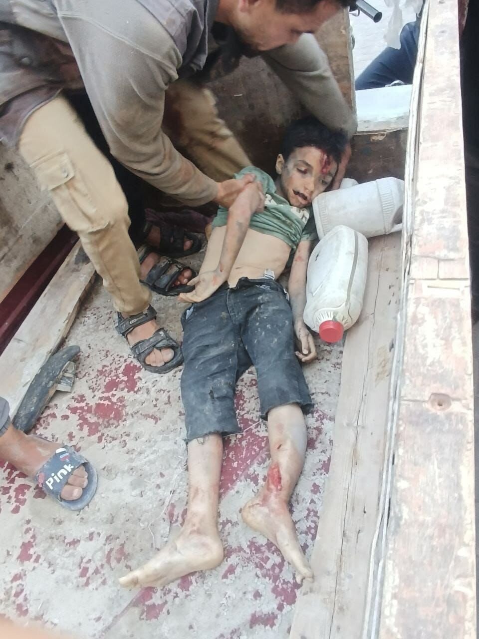 ۱۸+ تصاویری دردناک از پیکرهای کودکان به شهادت رسیده در حمله اخیر اشغالگران صهیونیست