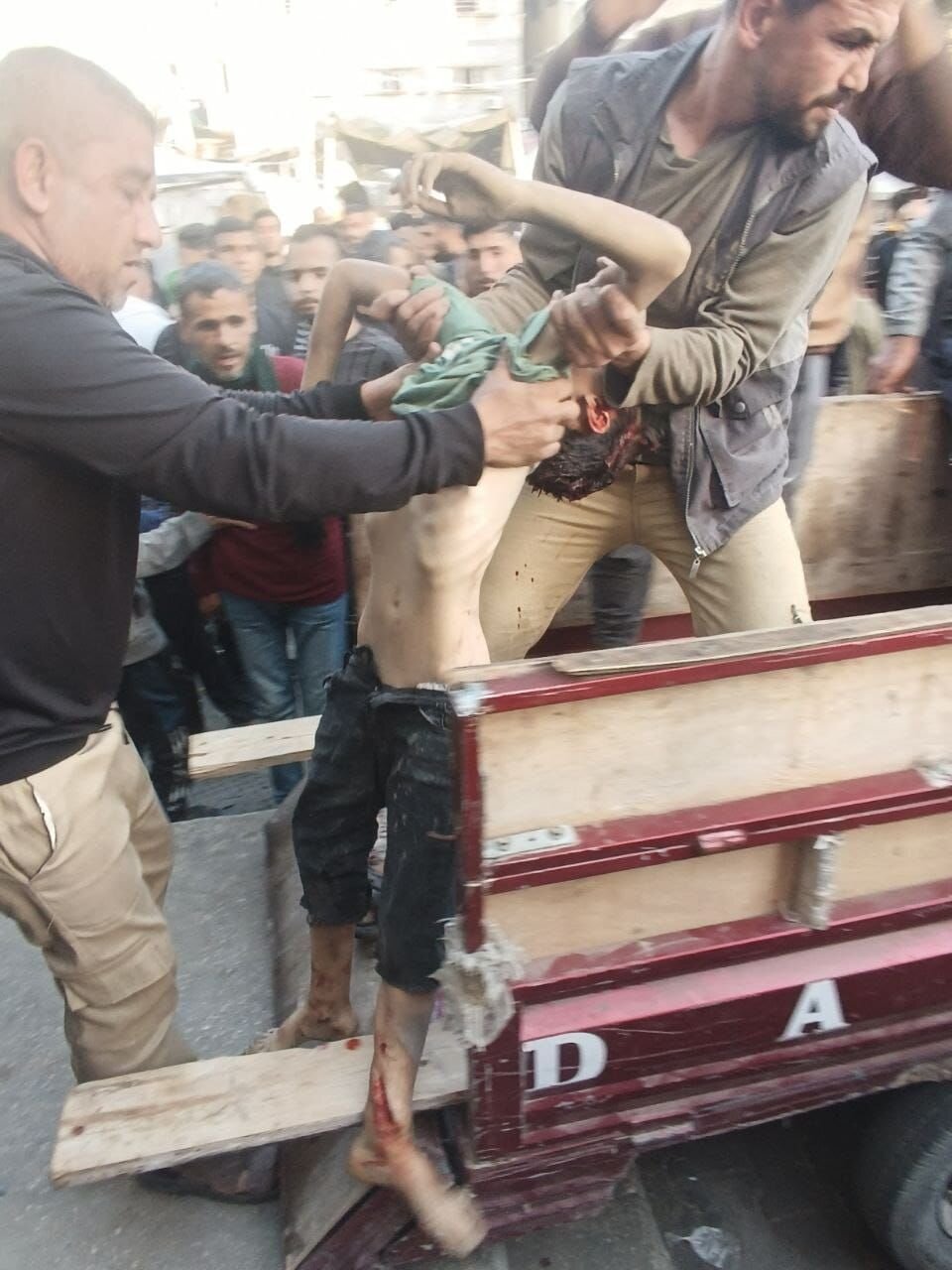 ۱۸+ تصاویری دردناک از پیکرهای کودکان به شهادت رسیده در حمله اخیر اشغالگران صهیونیست