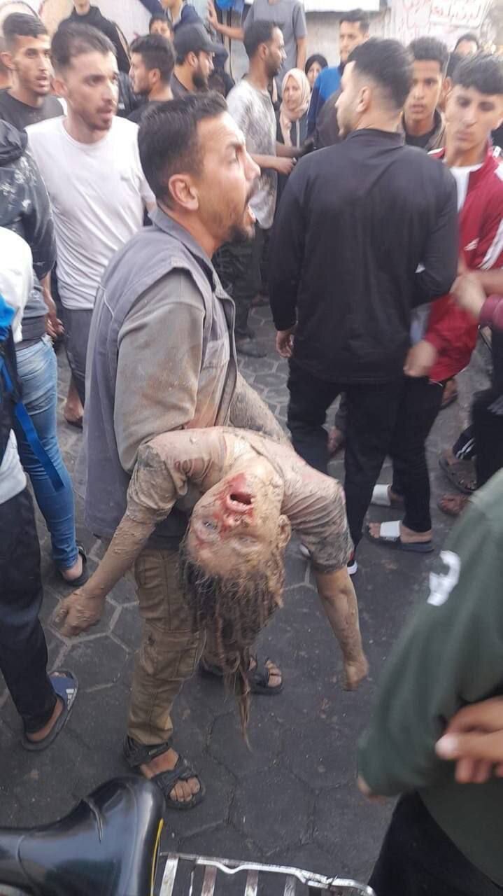 ۱۸+ تصاویری دردناک از پیکرهای کودکان به شهادت رسیده در حمله اخیر اشغالگران صهیونیست