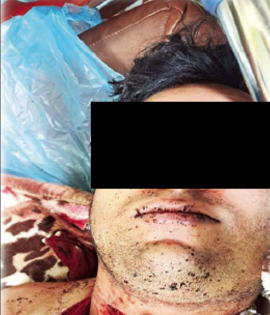 تصاویر ۱۸+ | جنایت هـولناک مرد جوان در کشاکش طلاق | زنم میخواست با عشقش ازدواج کند