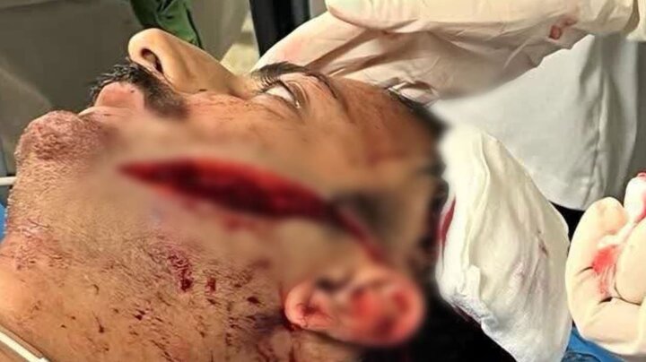 ۵۰ درصد از صورتم با تیزی قمه‌ فلج کردند | صحنه بازسازی شده حمله قمه‌کش یه شهروند بابلی را ببینید