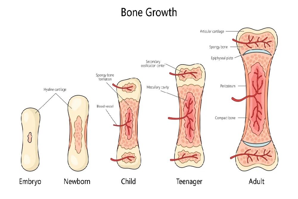 گم شدن حدود ۱۰۰ استخوان بدن کودک در بزرگسالی!