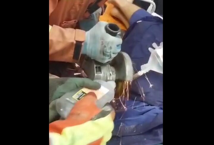 16+ لحظه بیرون آوردن میلگرد از بدن کارگر ساختمانی | ویدئو