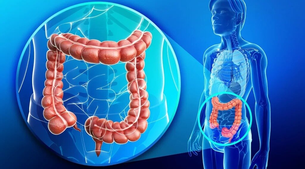 درباره سرطان روده بزرگ چه می‌دانید؟ | علائم، مراحل گسترش خطر، علل و انواع درمان