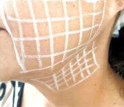 میکروبوتاکس برای چه کسانی مناسب است؟ | چه تفاوتی با بوتاکس دارد؟