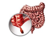 افزایش موارد یک سرطان خیلی نادر در میان جوانان