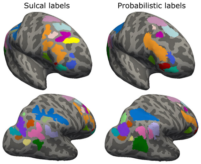 «شناخت» عمیقتر با چین خوردگیهای مغز!