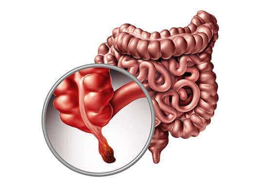appendix